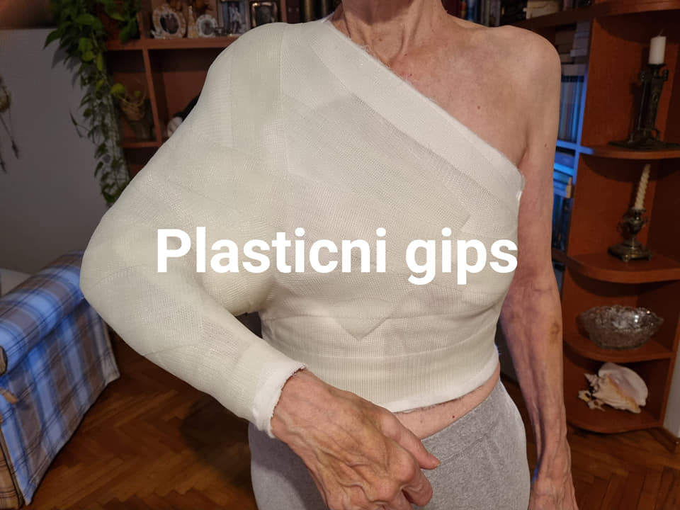 Plastični gips :: plastični.gips