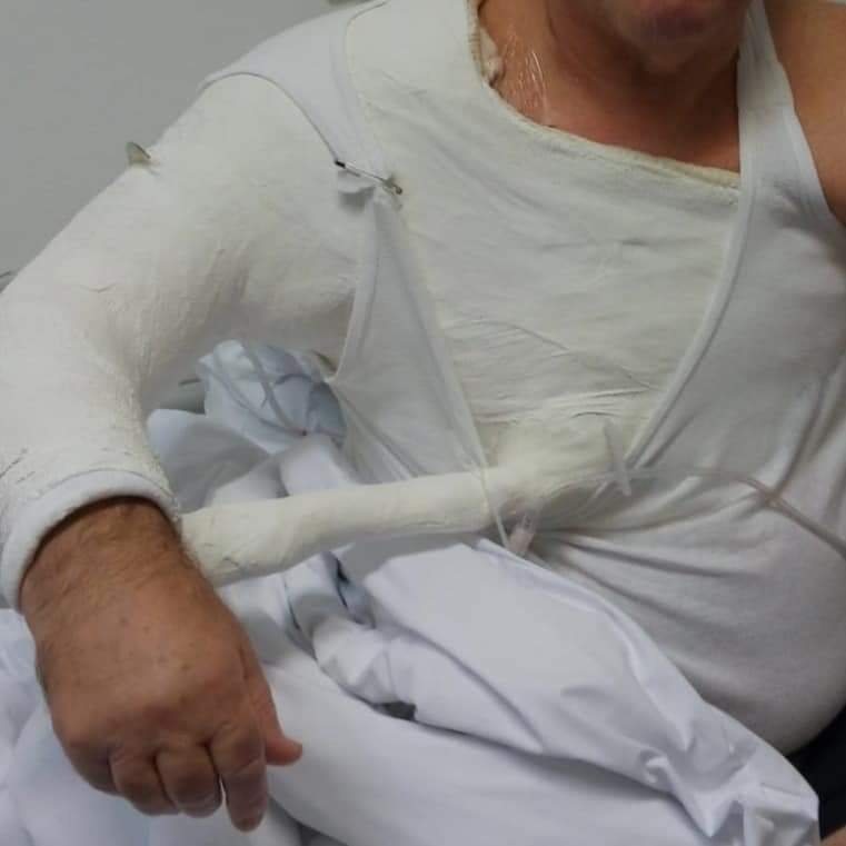 Plastični gips :: plastični.gips