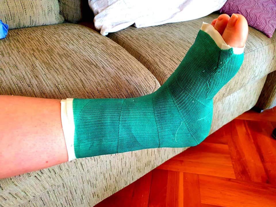 Plastični gips :: plastični.gips