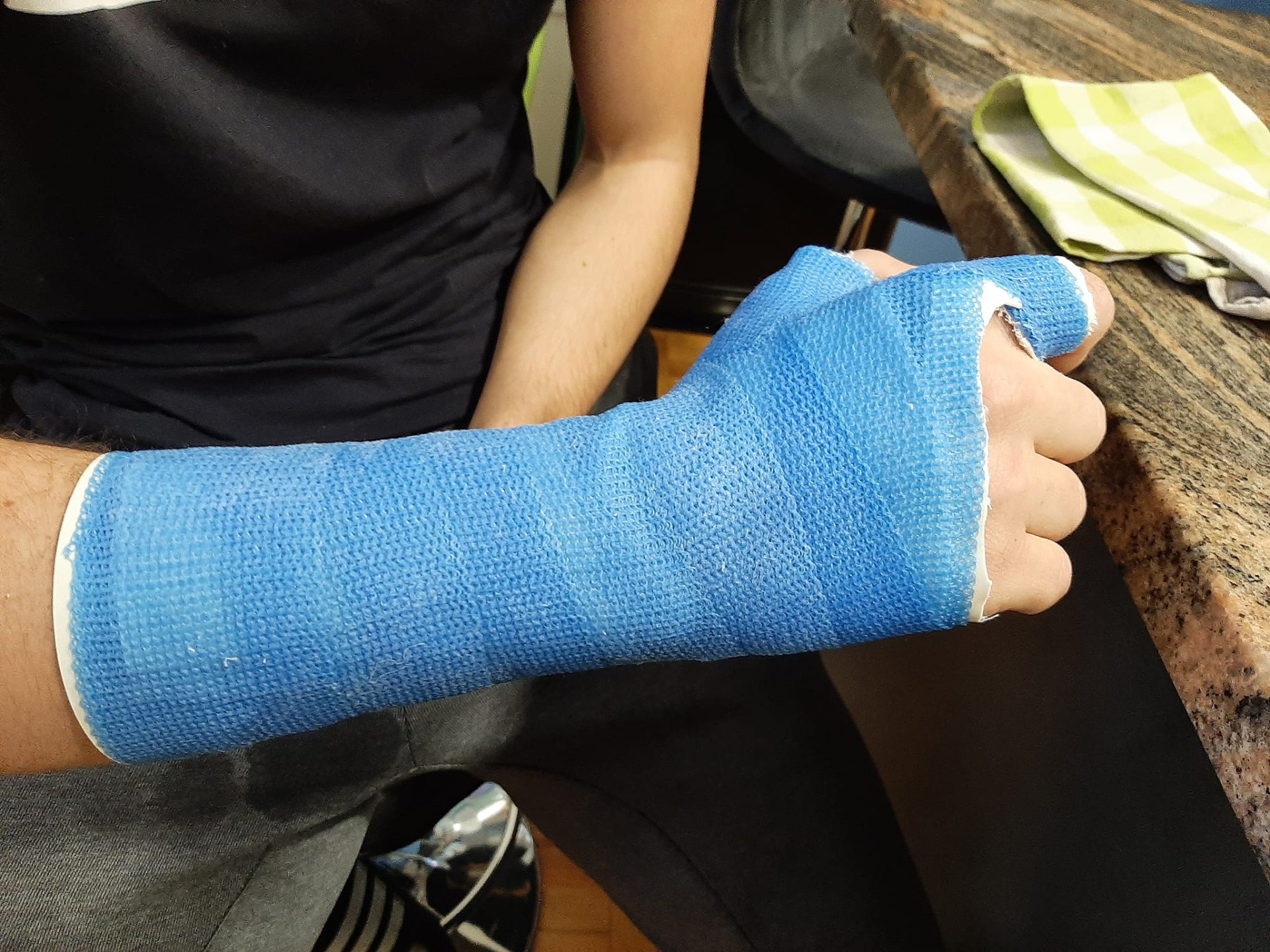 Plastični gips :: plastični.gips