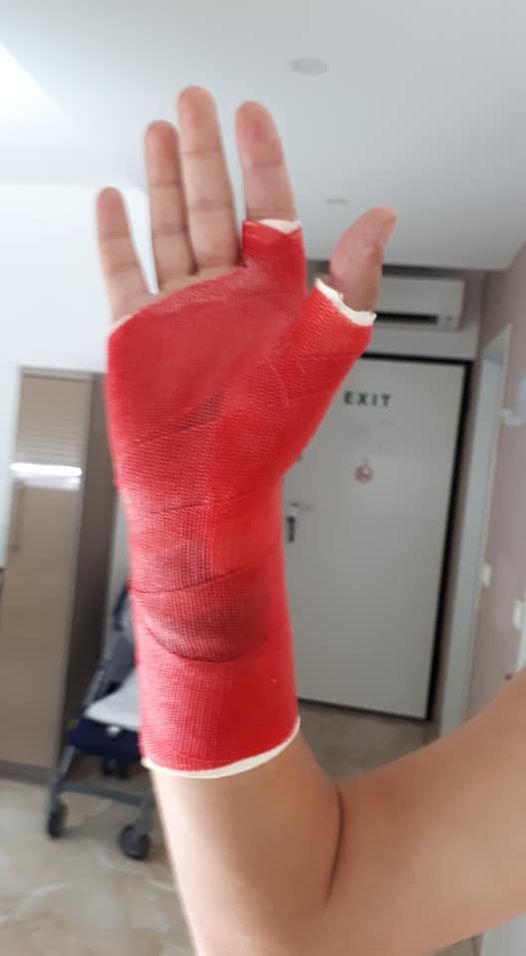 Plastični gips :: plastični.gips