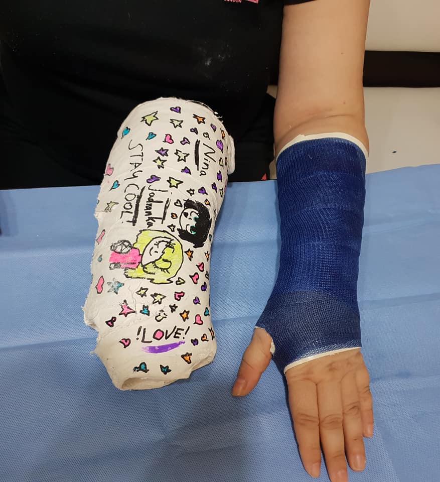 Plastični gips :: plastični.gips