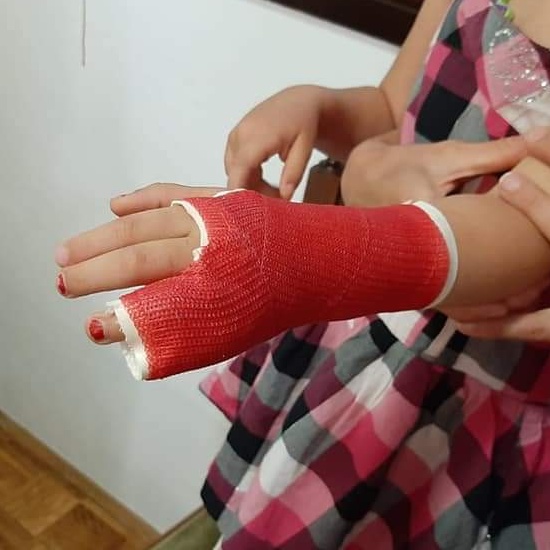 Plastični gips :: plastični.gips