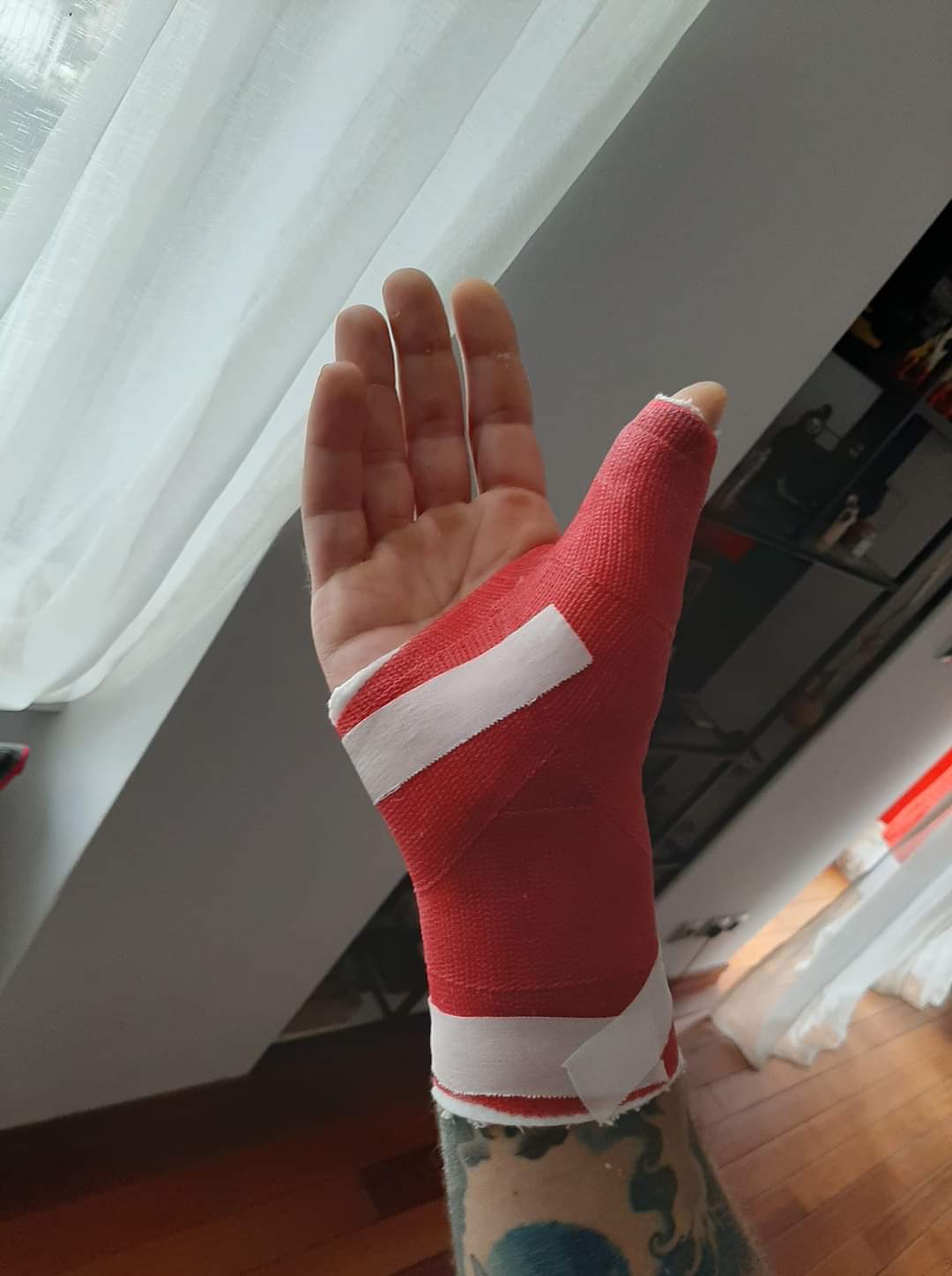 Gips Ruka Plastični gips :: plastični.gips
