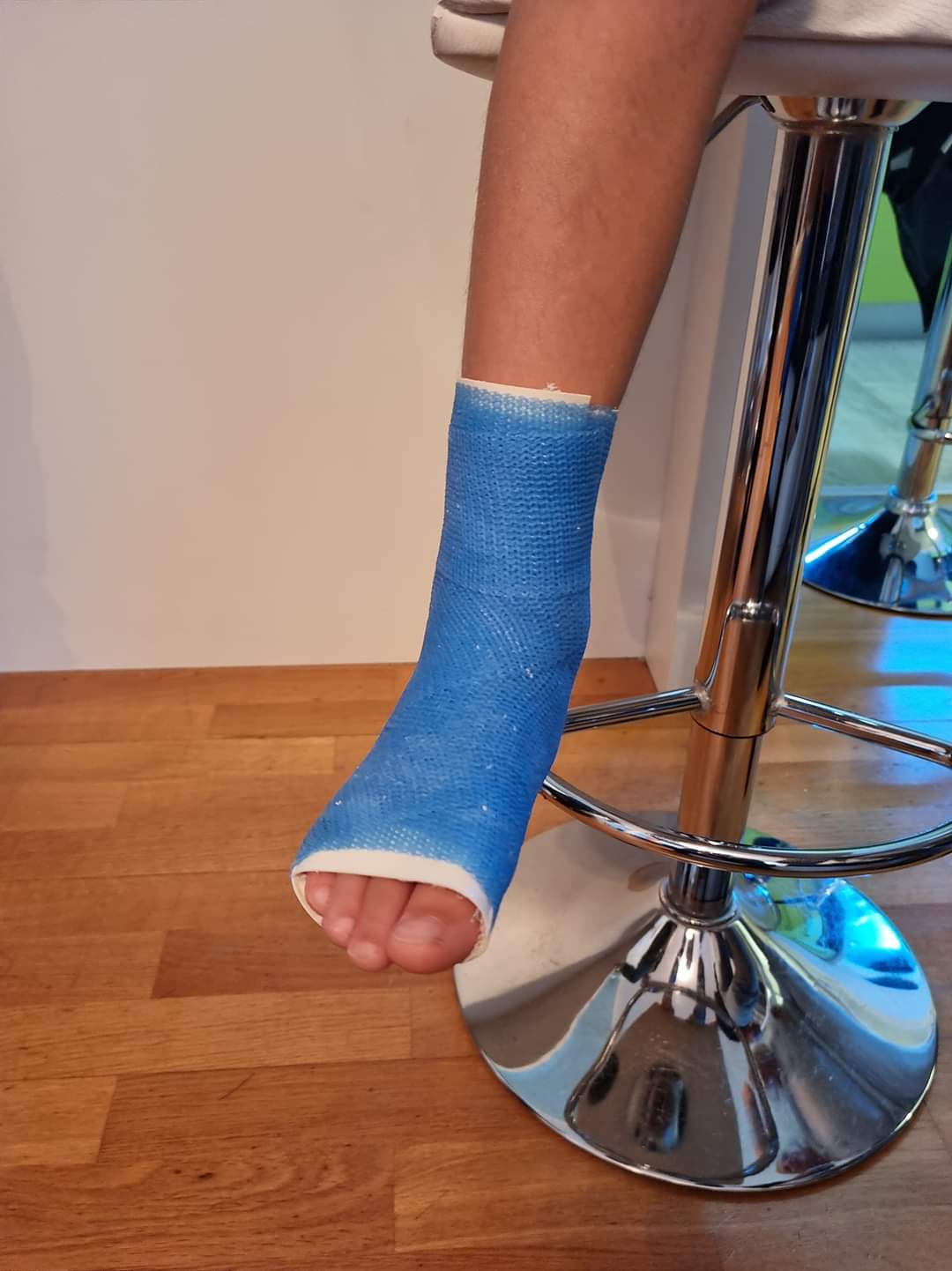 Gips Ruka Plastični gips :: plastični.gips